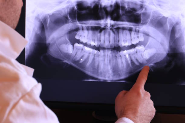 Best Emergency Broken Tooth Repair in Lawrencevle, IL
