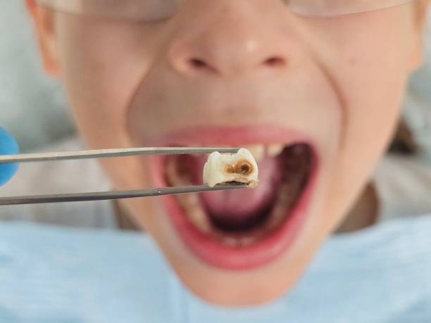 Best After-Hours Emergency Dentist in Lawrencevle, IL